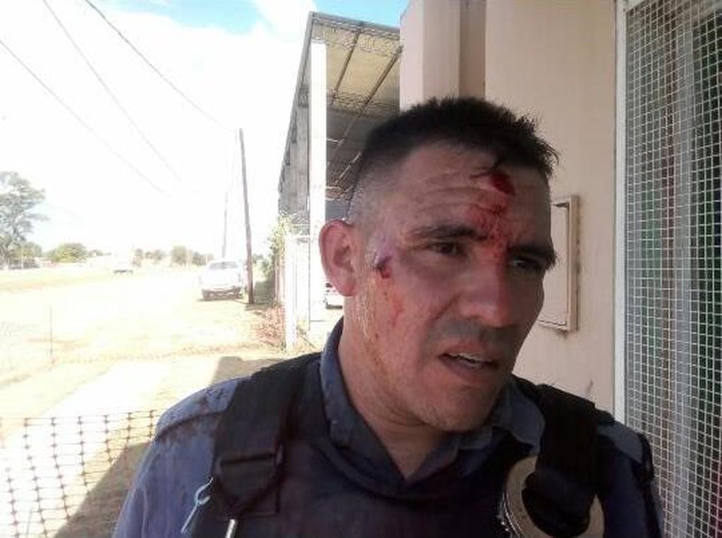 Alguno de los policías heridos por las piedras en Ingeniero Juárez